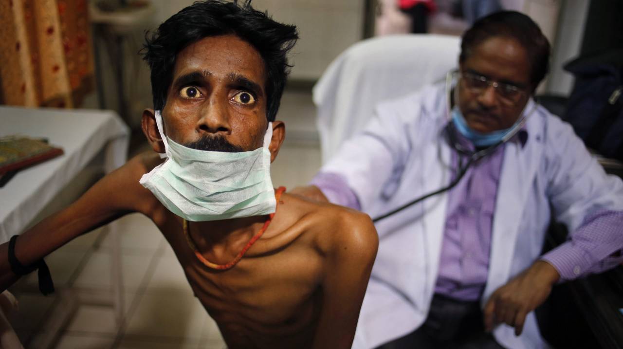 An Indian doctor examines a tuberculosis patient in a government TB hospital on World Tuberculosis Day in Allahabad, India, Monday, March 24, 2014. India has the highest incidence of TB in the world, according to the World Health Organization's Global Tuberculosis Report 2013, with as many as 2.4 million cases. India saw the greatest increase in multidrug-resistant TB between 2011 and 2012. The disease kills about 300,000 people every year in the country. (AP Photo/Rajesh Kumar Singh)