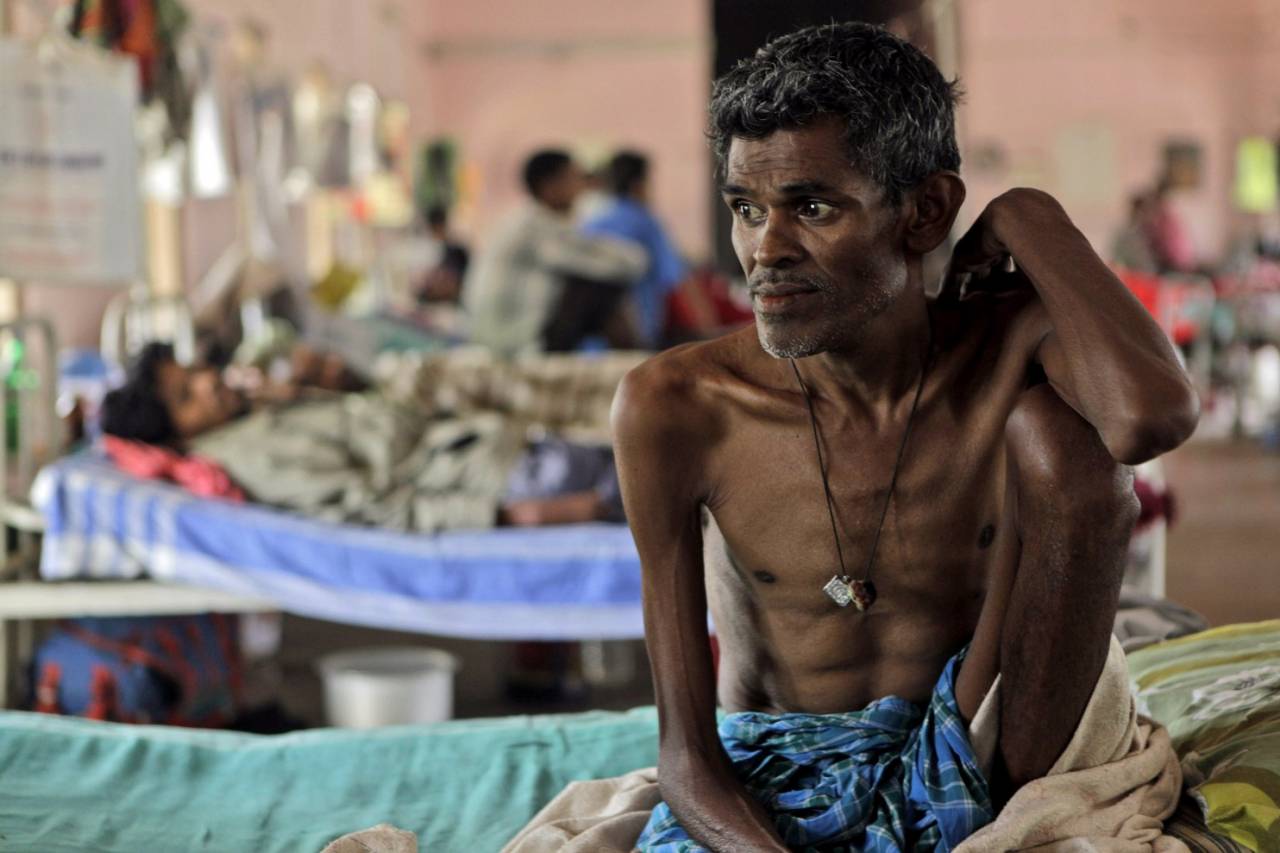 TB cases increase by 19% in India, highest in Delhi